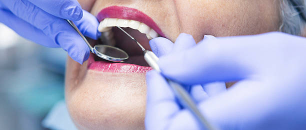 Best Emergency Wisdom Teeth Removal in Venice Gardens, FL